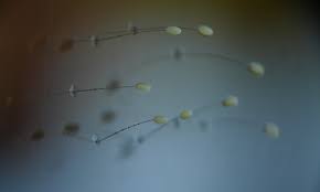 Attēlu rezultāti vaicājumam “Chrysopidae eggs”