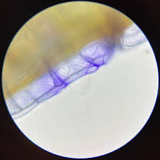 Attēlu rezultāti vaicājumam “Sphagnum papillosum”
