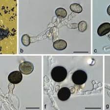 Attēlu rezultāti vaicājumam “Comatricha elegans var. microspora spores”