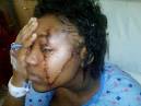 Carina Bernard, 18, of Bedford-Stuyvesant, was busted Monday for allegedly ... - images?q=tbn:ANd9GcRRZPLn5NkhmJk9_AUevO_5Rtw7DXXBC9Qw2zziYha6D6kvmGLGkzmU9SA