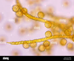 Attēlu rezultāti vaicājumam “Trichia scabra”