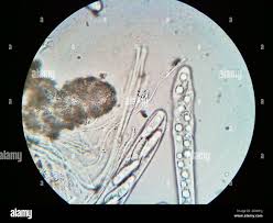 Attēlu rezultāti vaicājumam “Propolis farinosa”