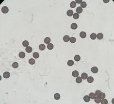 Attēlu rezultāti vaicājumam “Badhamia lilacina spores”