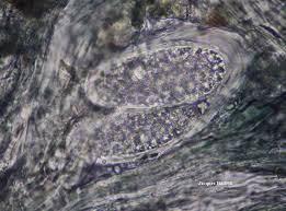 Attēlu rezultāti vaicājumam “Mycoblastus sanguinarius”