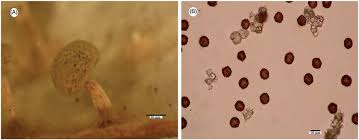 Attēlu rezultāti vaicājumam “Didymium difforme spores”