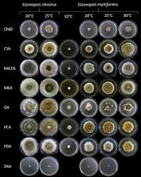 Attēlu rezultāti vaicājumam “Stemonitopsis aequalis var. microspora”