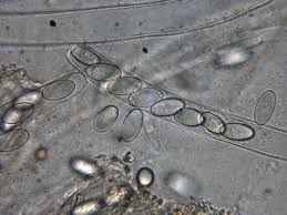 Attēlu rezultāti vaicājumam “Peziza flavida”