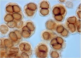 Attēlu rezultāti vaicājumam “Urocystis anemones spores”