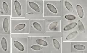 Attēlu rezultāti vaicājumam “Amaurochaete atra spores”