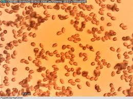 Attēlu rezultāti vaicājumam “Ceriporiopsis aneirina”