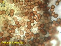 Attēlu rezultāti vaicājumam “Tranzschelia pruni-spinosae spores”