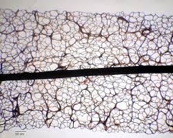 Attēlu rezultāti vaicājumam “Stemonitis sp.”