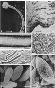Attēlu rezultāti vaicājumam “Microcalicium disseminatum”