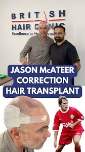 Image result for Liverpool Transplant FC