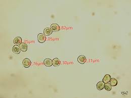 Attēlu rezultāti vaicājumam “Trichia alpina spores”