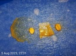 Attēlu rezultāti vaicājumam “Badhamia sp.”