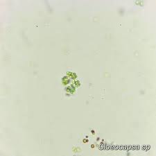 Attēlu rezultāti vaicājumam “Gloeocapsa rupestris”