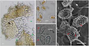 Attēlu rezultāti vaicājumam “Melampsoridium sp.”