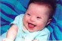 For Having Down <b>Syndrome</b>