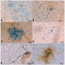 Attēlu rezultāti vaicājumam “Stemonitopsis aequalis var. microspora spores”