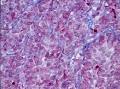 Acidophilic Archaea