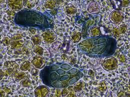 Attēlu rezultāti vaicājumam “Lecanora conizaeoides”