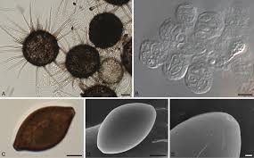 Attēlu rezultāti vaicājumam “Badhamia melanospora spores”