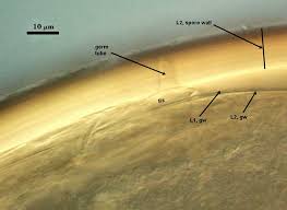 Attēlu rezultāti vaicājumam “Licea castanea spores”