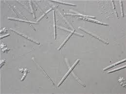 Attēlu rezultāti vaicājumam “Enteridium liceoides spores”