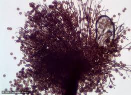 Attēlu rezultāti vaicājumam “Lamproderma pulchellum spores”