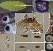Attēlu rezultāti vaicājumam “Rosellinia desmazieri spores”