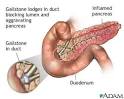 Acute <b>Pancreatitis</b>