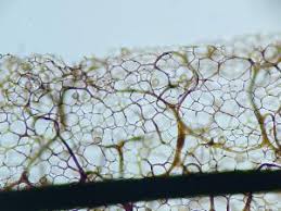 Attēlu rezultāti vaicājumam “Stemonitis splendens spores”