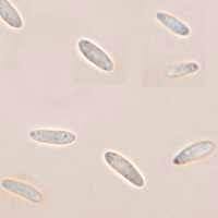 Attēlu rezultāti vaicājumam “Mollisia amenticola”