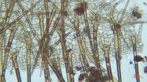 Attēlu rezultāti vaicājumam “Cheilymenia stercorea”