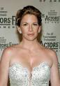 MELISSA GILBERT Plastic Surgery Before And After Photos