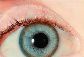 Kuvahaun tulos haulle Kayser-Fleischer