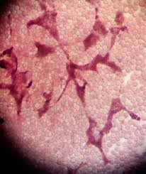 Attēlu rezultāti vaicājumam “Cribraria oregana spores”