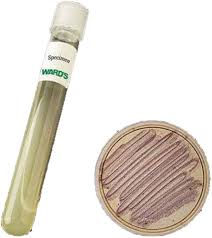 Attēlu rezultāti vaicājumam “Sordaria fimicola”