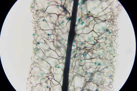 Attēlu rezultāti vaicājumam “Comatricha sp.”