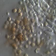 Attēlu rezultāti vaicājumam “Chaenotheca trichialis”