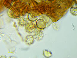 Attēlu rezultāti vaicājumam “Badhamia affinis var. microspora macro”