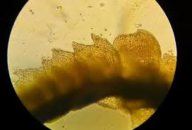 Attēlu rezultāti vaicājumam “Barbilophozia lycopodioides macro”