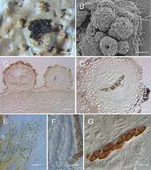 Attēlu rezultāti vaicājumam “Didymium verrucisporum spores”