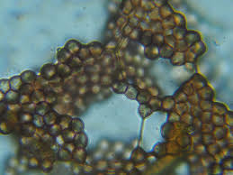 Attēlu rezultāti vaicājumam “Physarum xanthinum sessile”