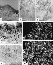 Attēlu rezultāti vaicājumam “Biatoropsis usnearum”