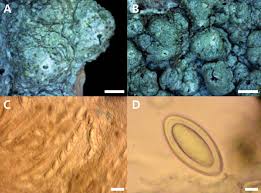 Attēlu rezultāti vaicājumam “Pertusaria albescens”