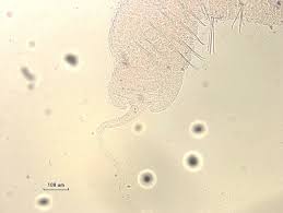 Attēlu rezultāti vaicājumam “Heterotrichia pomiformis (syn. Arcyria pomiformis) macro”