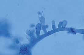 Attēlu rezultāti vaicājumam “Myriosclerotinia scirpicola”