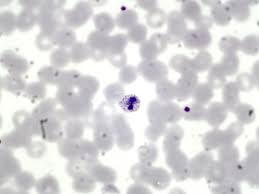 Attēlu rezultāti vaicājumam “Enteridium variabile plasmodium”